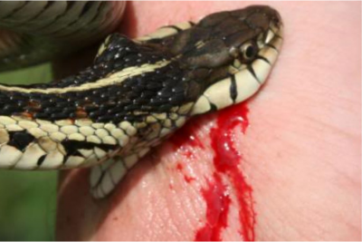 सर्पदंश प्राथमिक उपचार केन्द्रलाई हस्पिटलमा स्तरोन्नति गरिने