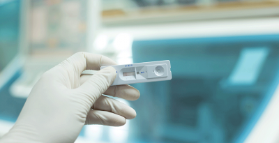 विदेशबाट आएका सबैको अनिवार्य कोरोनाको परीक्षण गर्नुपर्ने